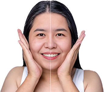 Anti-aging Treatment